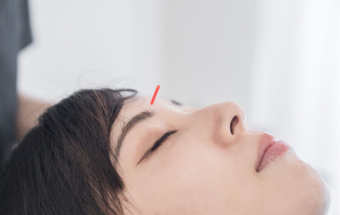  痛みとダウンタイムが少ない