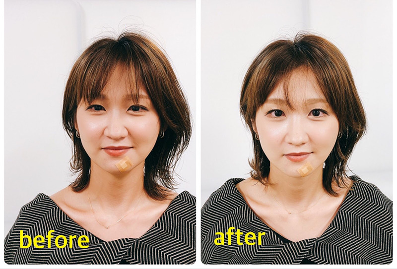 ビフォーアフター