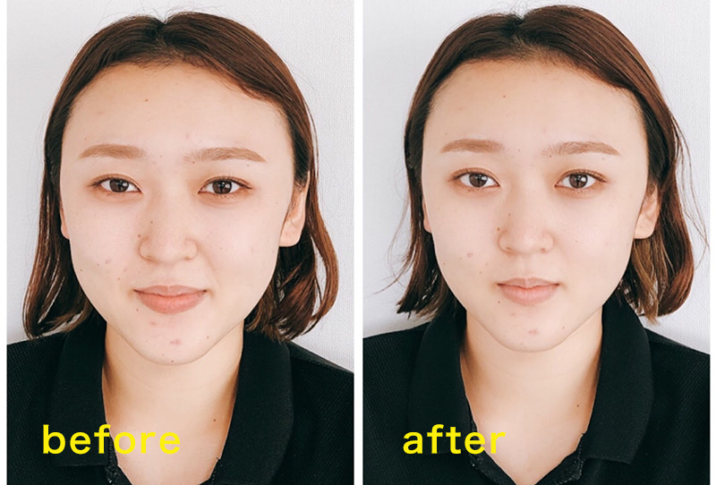 ビフォーアフター