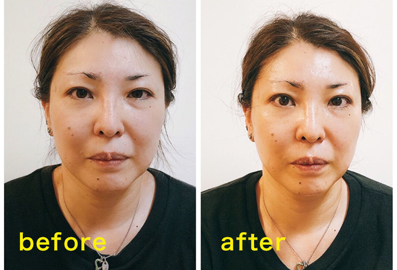 ビフォーアフター