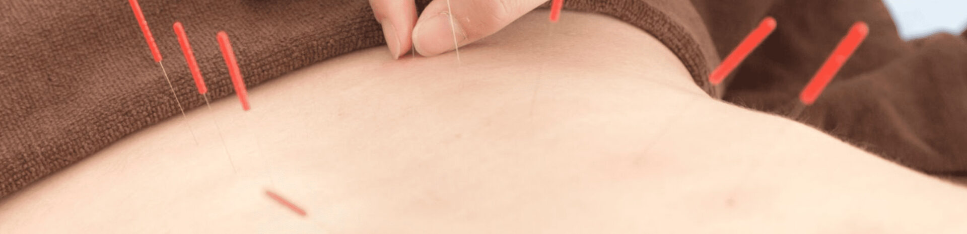 当院の鍼灸・整体